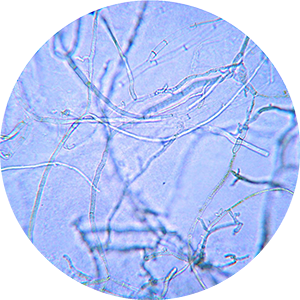 Sclerotinia timber rot hyphae at 400x magnification